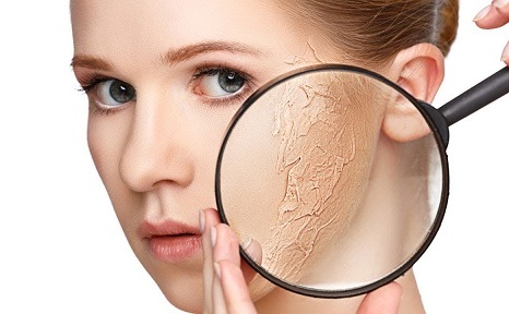 Aloe vera Treats Dead Skin