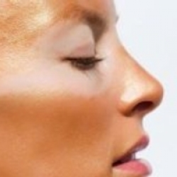 How to Hide a Sunburn with Make Up