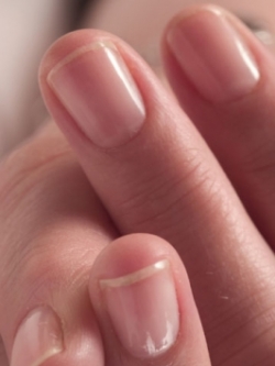 Fixes for Common Nail Problems