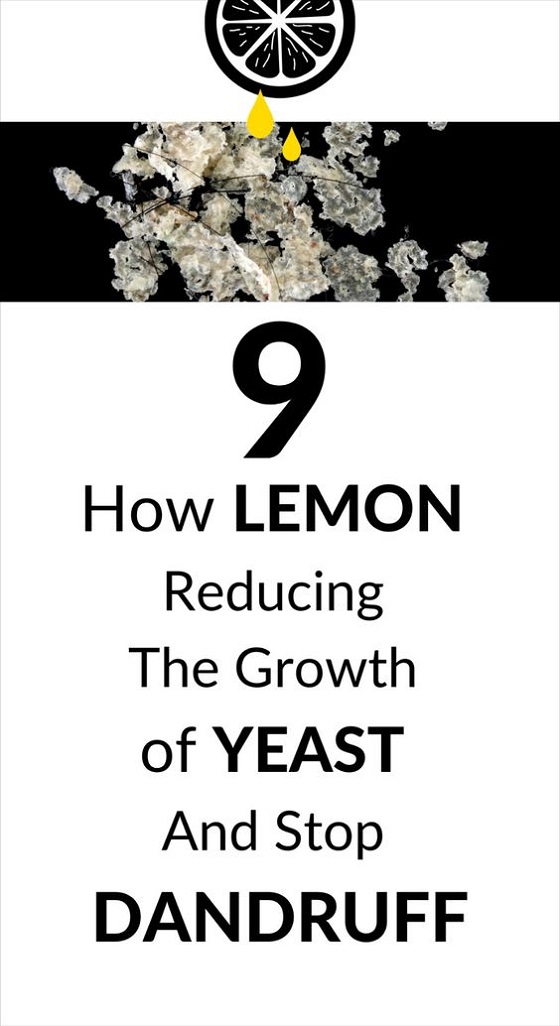 9 Ways to Use Lemon for Dandruff Treatment | I Fashion Styles