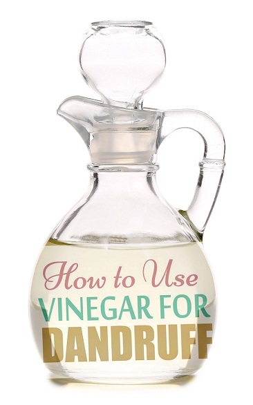 How To Use Apple Cider Vinegar For Dandruff? 8 Methods That Work!