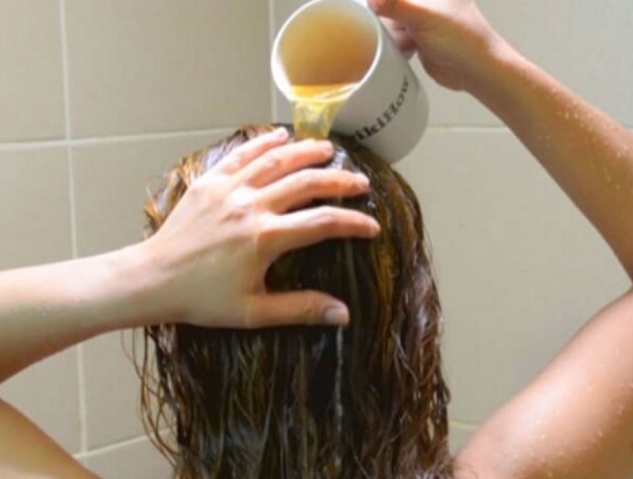 How To Use Apple Cider Vinegar For Dandruff? 8 Methods That Work!