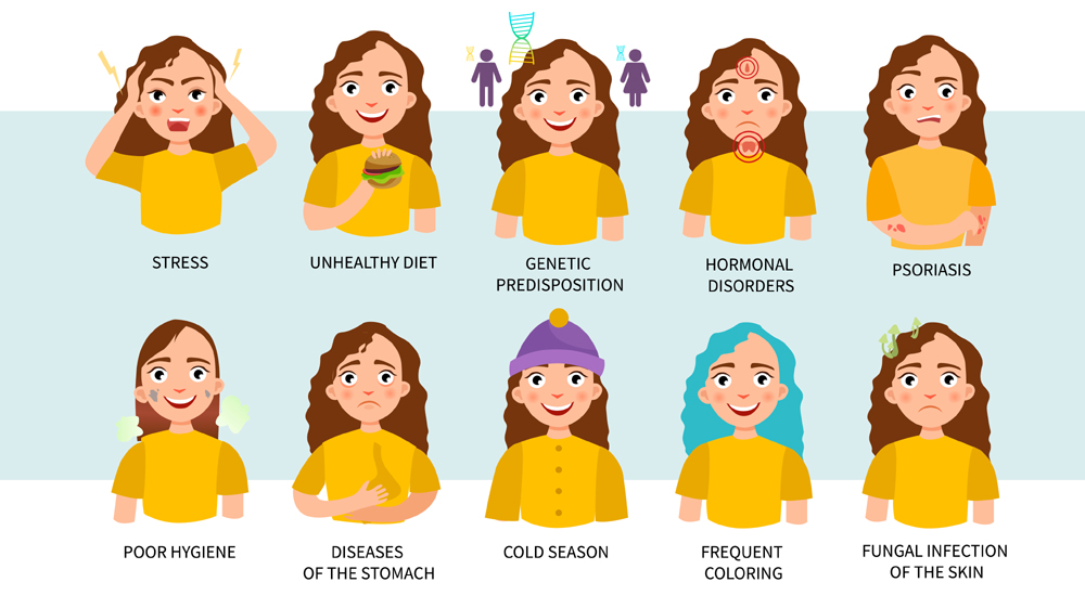 10 Main Causes Of Dandruff On Your Scalp! | I Fashion Styles