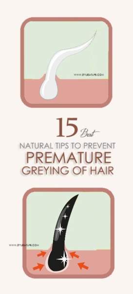 How To Prevent Premature Greying Of Hair? | I Fashion Styles