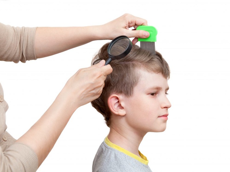 What Causes Hair Loss In Children? | I Fashion Styles