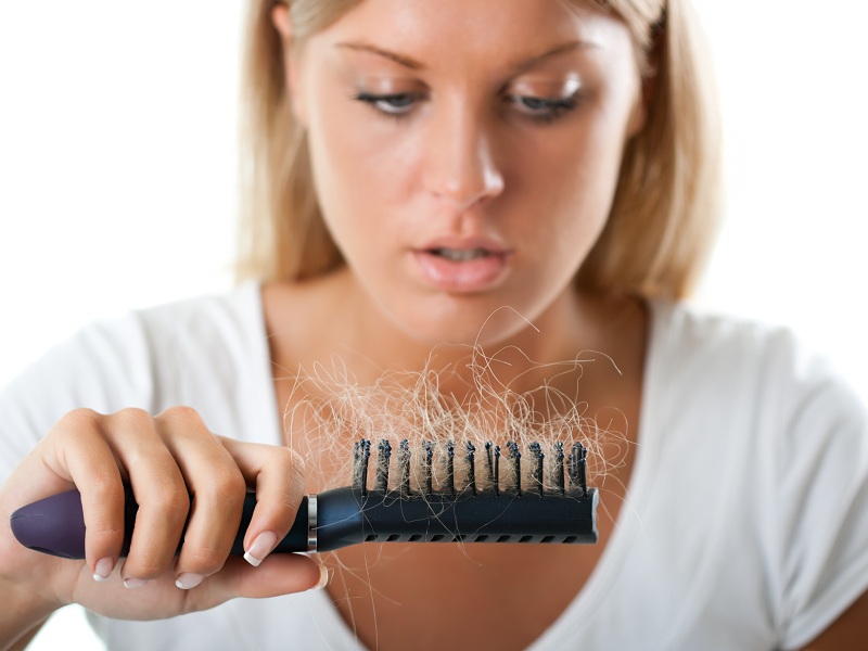 What causes DHT Hair Loss and How to Treat It? | I Fashion Styles