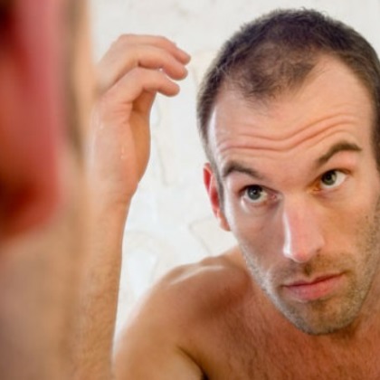 What causes DHT Hair Loss and How to Treat It? | I Fashion Styles