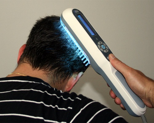 5 Effective Hair Growth Therapy Treatments | I Fashion Styles