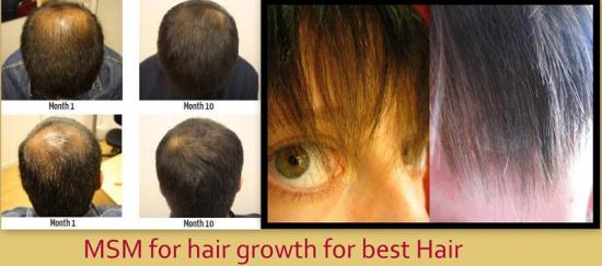 Is MSM Good for Hair Growth? | I Fashion Styles