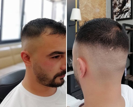 15 Trending Hairstyles for Balding Men (Top, Front &amp; Sides)