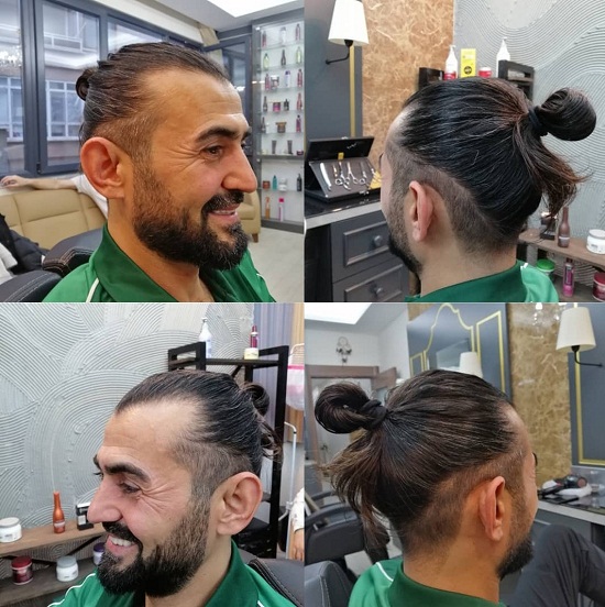 15 Trending Hairstyles for Balding Men (Top, Front &amp; Sides)