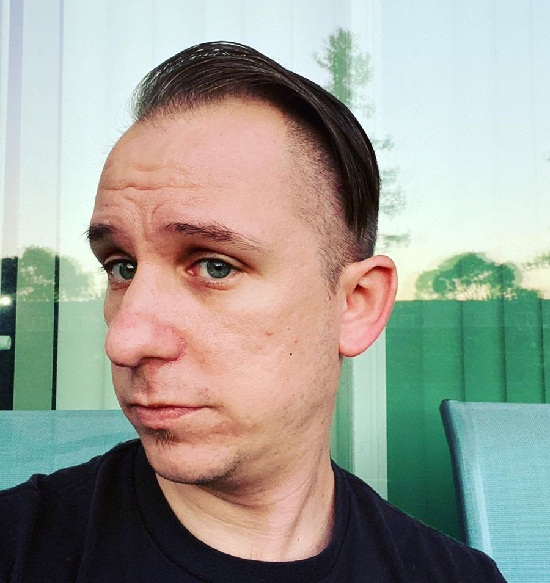 15 Trending Hairstyles for Balding Men (Top, Front &amp; Sides)