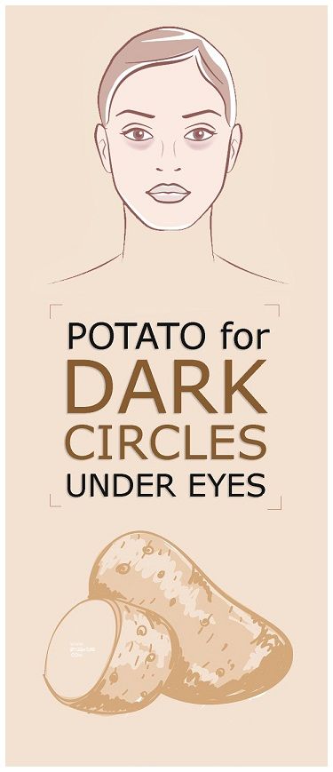 How to Reduce Dark Circles With the Help of Potatoes