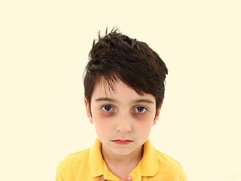 10 Effective Home Remedies for Dark Circles in Kids