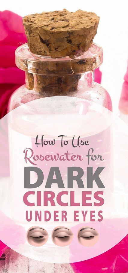 Rose Water for Dark Circles Under Eyes: 6 Best Ways to Use!