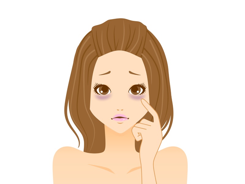 What Causes Dark Circles Under Eyes? and Remedies at Home