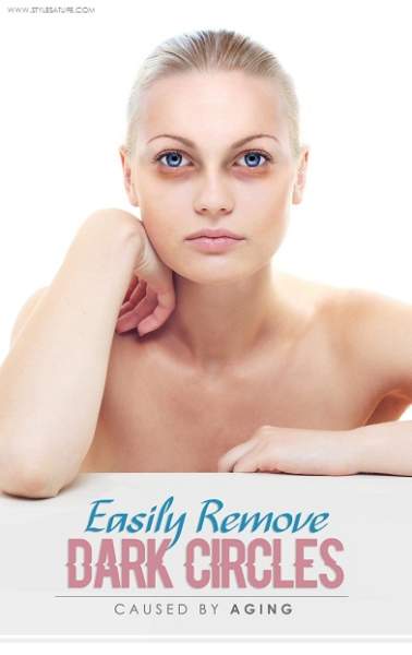 15 Fastest Ways to Remove Dark Circles Under Eyes
