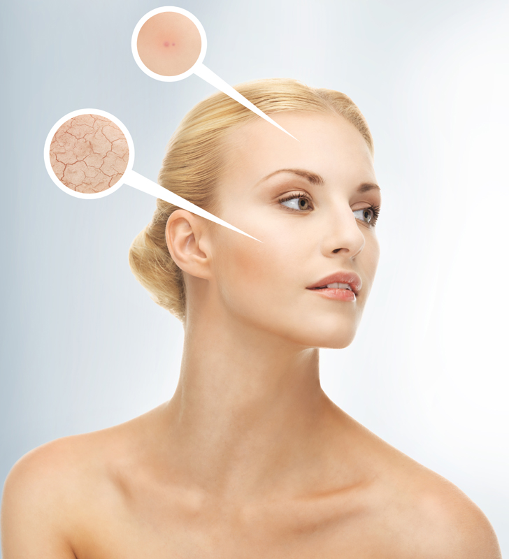 15 Best Home Remedies to Get Rid of Dry Skin Problems