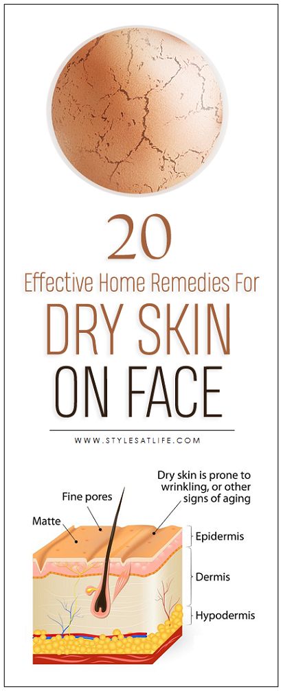 15 Best Home Remedies to Get Rid of Dry Skin Problems