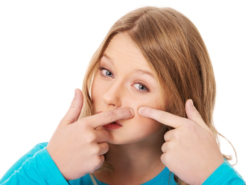 How To Remove Pimples (Acne) In One Day