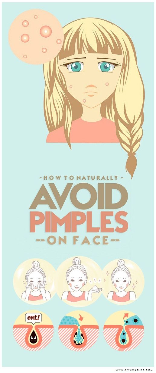 How to Avoid Pimples Causes and Tips for Prevention