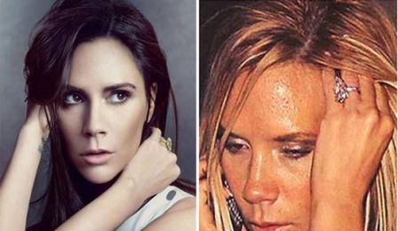 10 Famous Actresses Caught with Pimples On-Camera