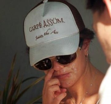 10 Famous Actresses Caught with Pimples On-Camera