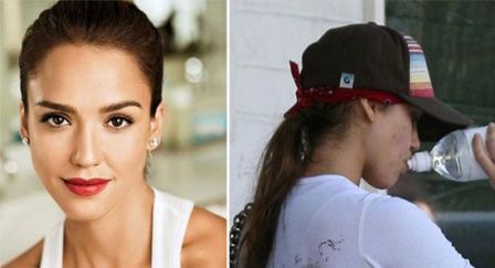 10 Famous Actresses Caught with Pimples On-Camera