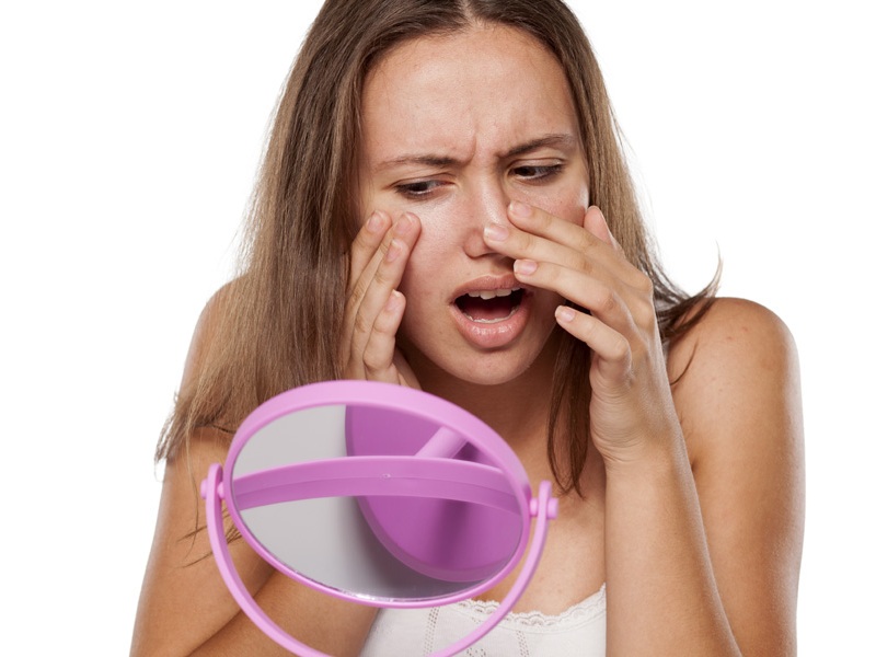 30 Natural Tips to Cure Pimples Completely from Face