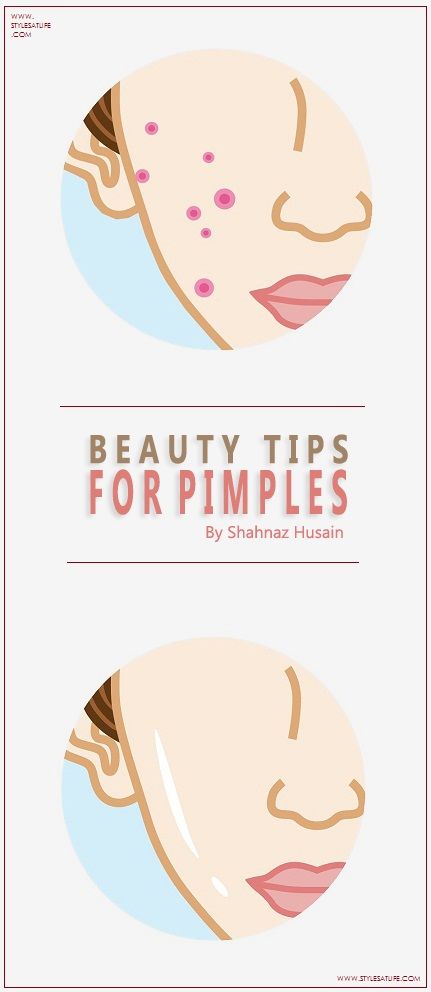 12 Best Shahnaz Hussain Beauty Tips For Acne | I Fashion Styles