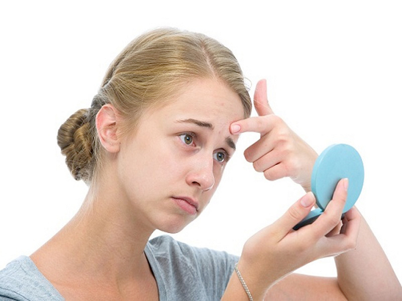 How to Get Rid of Acne Overnight | I Fashion Styles