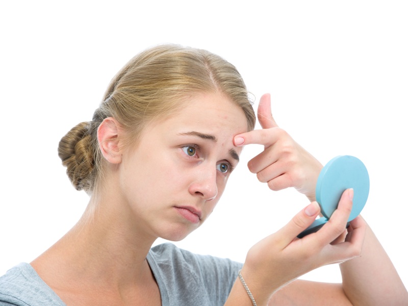 Is Sulfur For Acne Effective? | I Fashion Styles