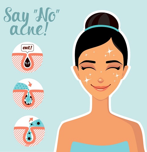 Different Types Of Pimples - How to Cure | I Fashion Styles