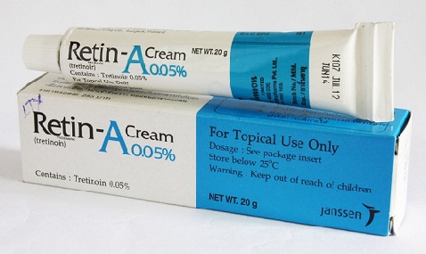 How to Get Rid of Stretch Marks Fast and Naturally? | I Fashion Styles