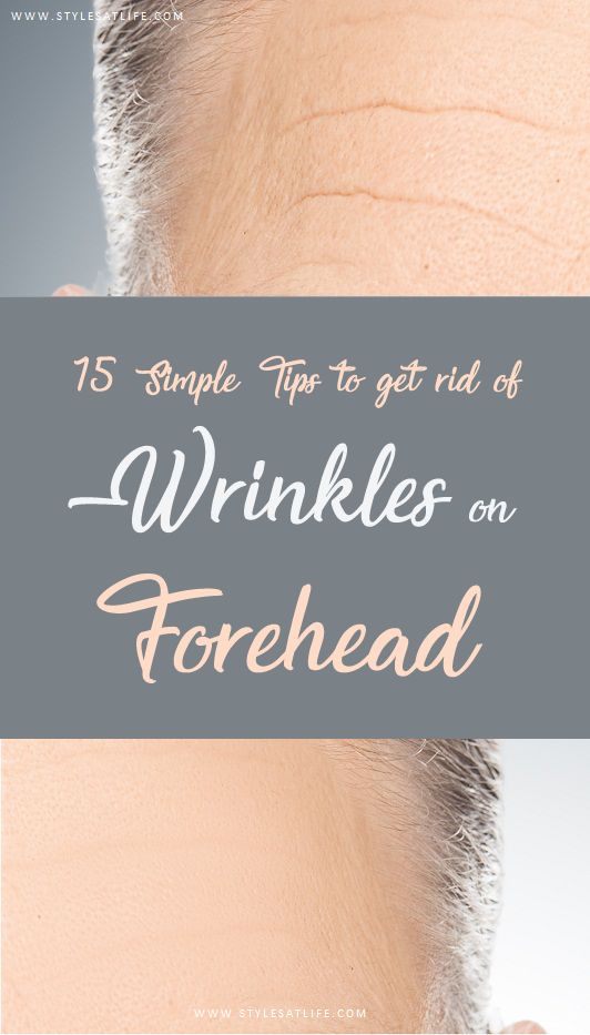 How To Remove Wrinkles From Forehead? | I Fashion Styles