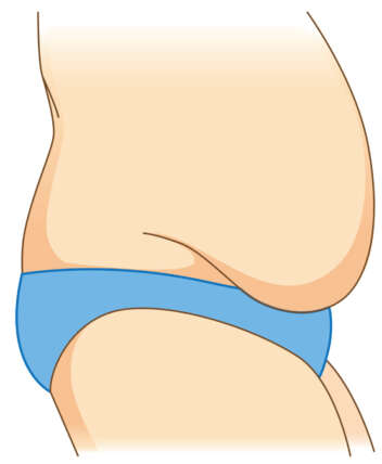 Reduce Belly Fat In One Month: 10 Effective Tips To Try At Home