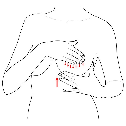 Breast Engorgement: How to Manage and Treat It