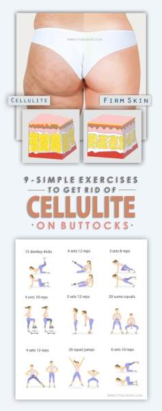 9 Simple Exercises To Get Rid of Cellulite On Buttocks