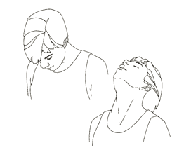 How To Reduce Face Fat Naturally: 15 Effective Tips And Exercises