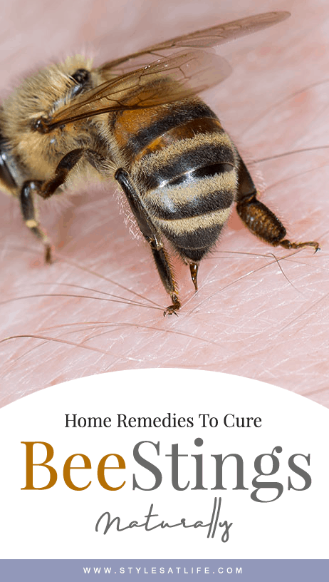 10 Best Home Remedies to Treat Honeybee Stings | I Fashion Styles