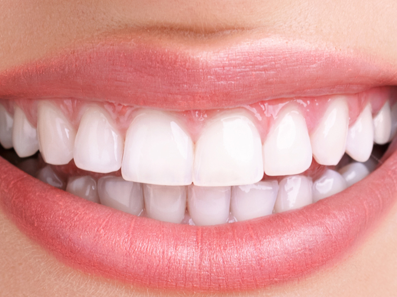 Yellow Teeth: 20 Best Home Remedies for Teeth Discoloration