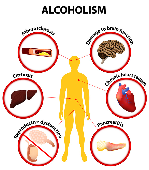 9 Best Natural Ways to Cure Morning Hangover (2-4 Days)