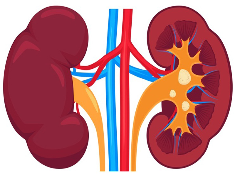 20 Best Indian Home Remedies For Kidney Stones At Home