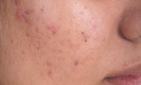 10 Research-Based Benefits Of Patanjali Amla Juice + Side Effects