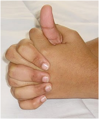 Mudras For Bronchitis - How To Do Steps And Benefits| I Fashion Styles