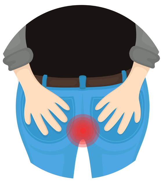 9 Signs and Symptoms of Hemorrhoids You Should Know
