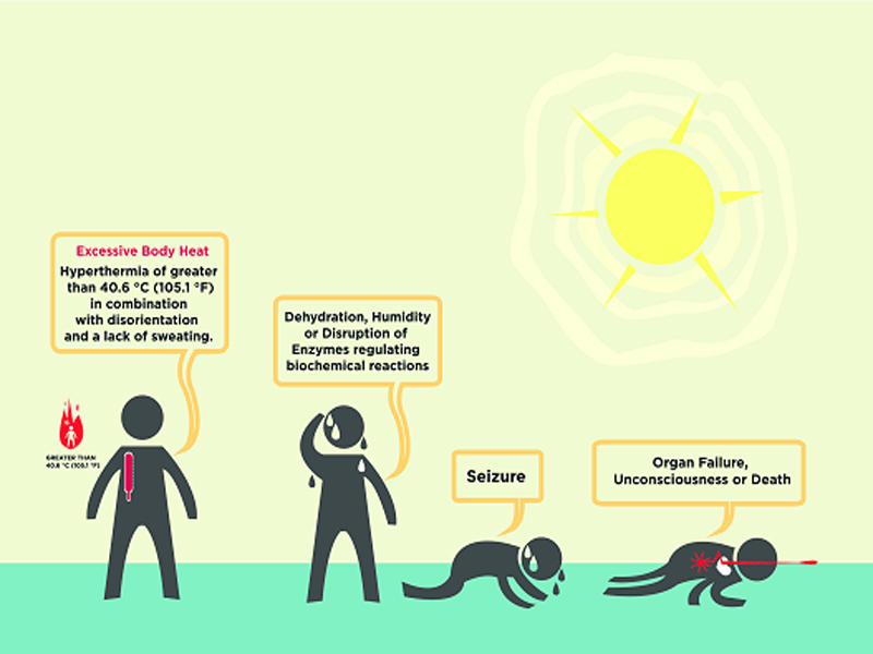 Symptoms of Seizure | I Fashion Styles