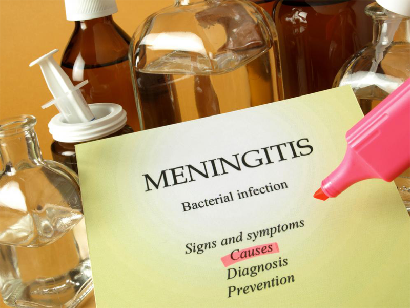 Meningitis Symptoms And Causes | I Fashion Styles