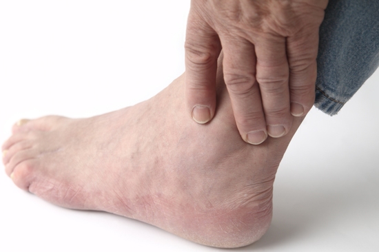 Identifying Gout: 9 Early Stage Symptoms | I Fashion Styles