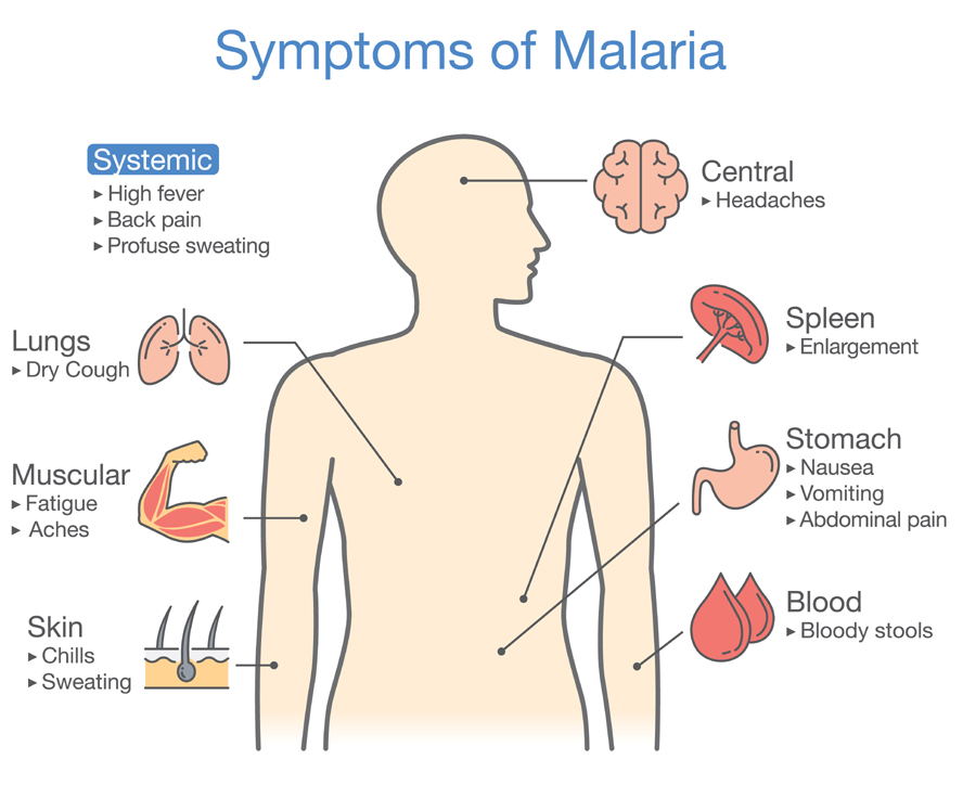 Malaria Symptoms, Causes, Complications And More | I Fashion Styles